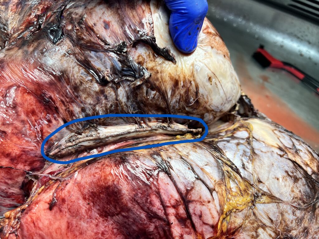 Attached partial stomach (circled in blue)
